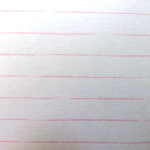 ピンク横線（拡大）